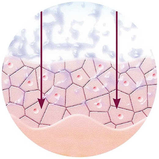 Wirkstoffe zur Regeneration werden appliziert